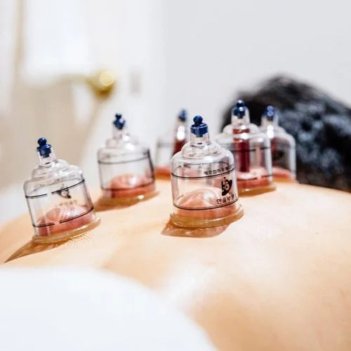 Wet Cupping